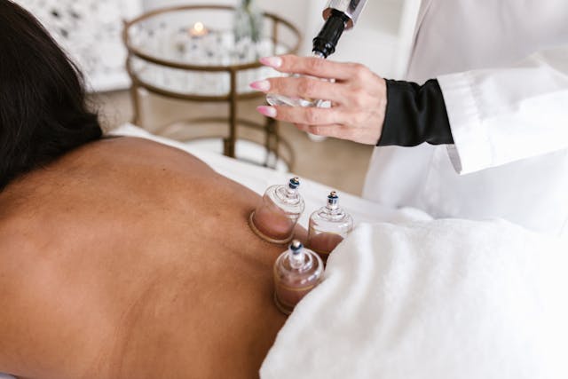 Why Cupping Therapy is the Ultimate Stress Relief Tool